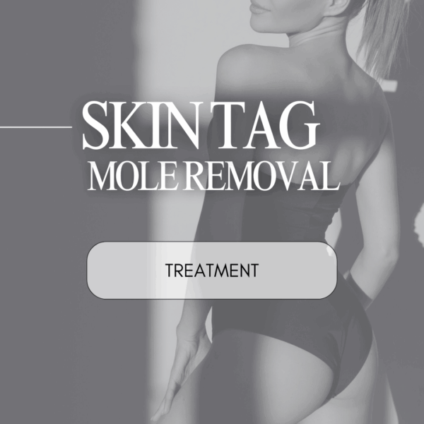 Skin Tag / Mole Removal