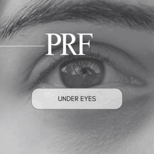 PRF Under Eyes